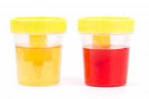 What The Color Of Your Urine Says About Your Health - MindWaft