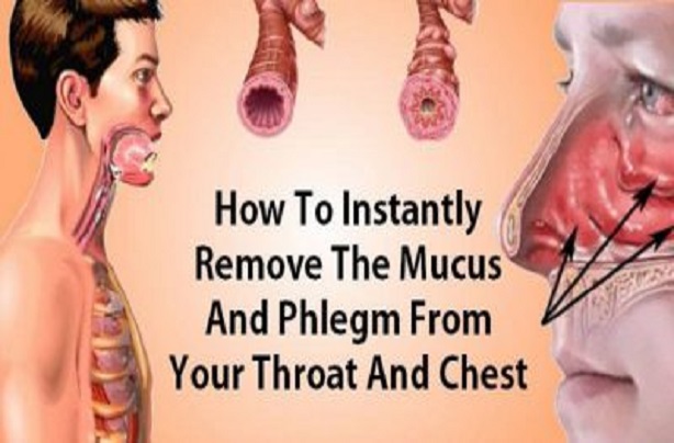 Get Rid of Phlegm and Mucus in Chest & Throat with These